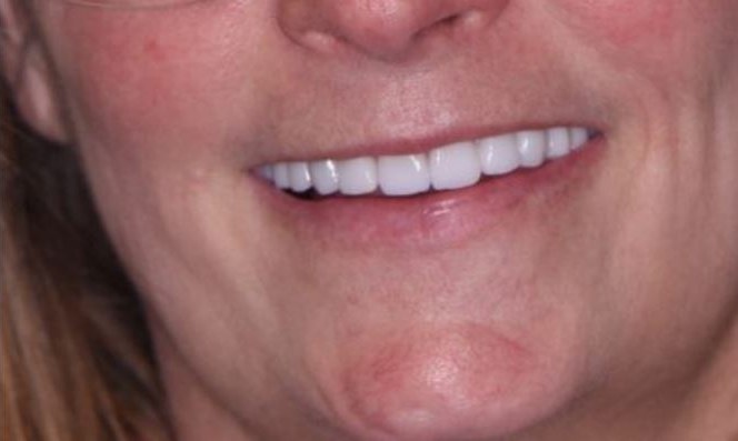 Case 01 after treatment