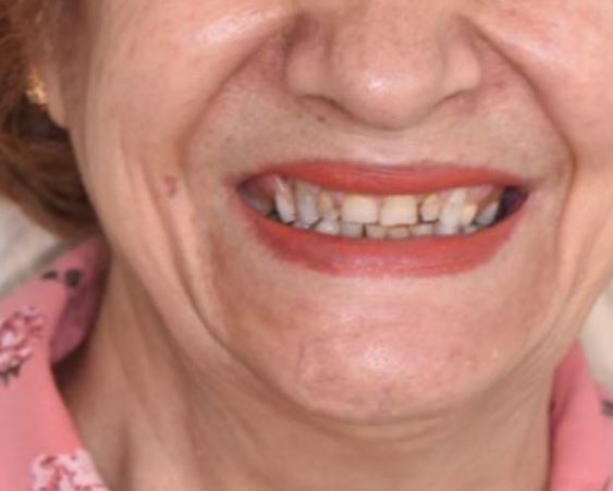 Case 02 before treatment