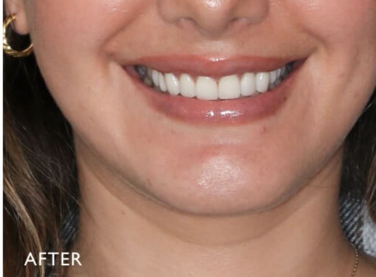 Case 04 after treatment