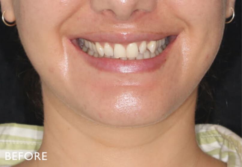 Case 04 before treatment
