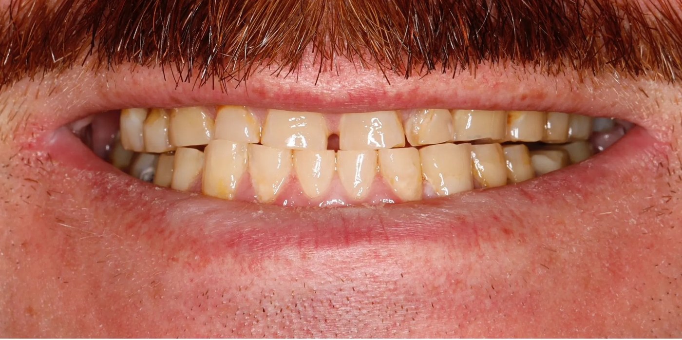 Case 05 before treatment